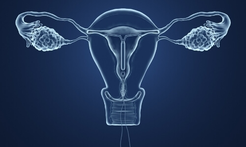 Insertion of an IUD